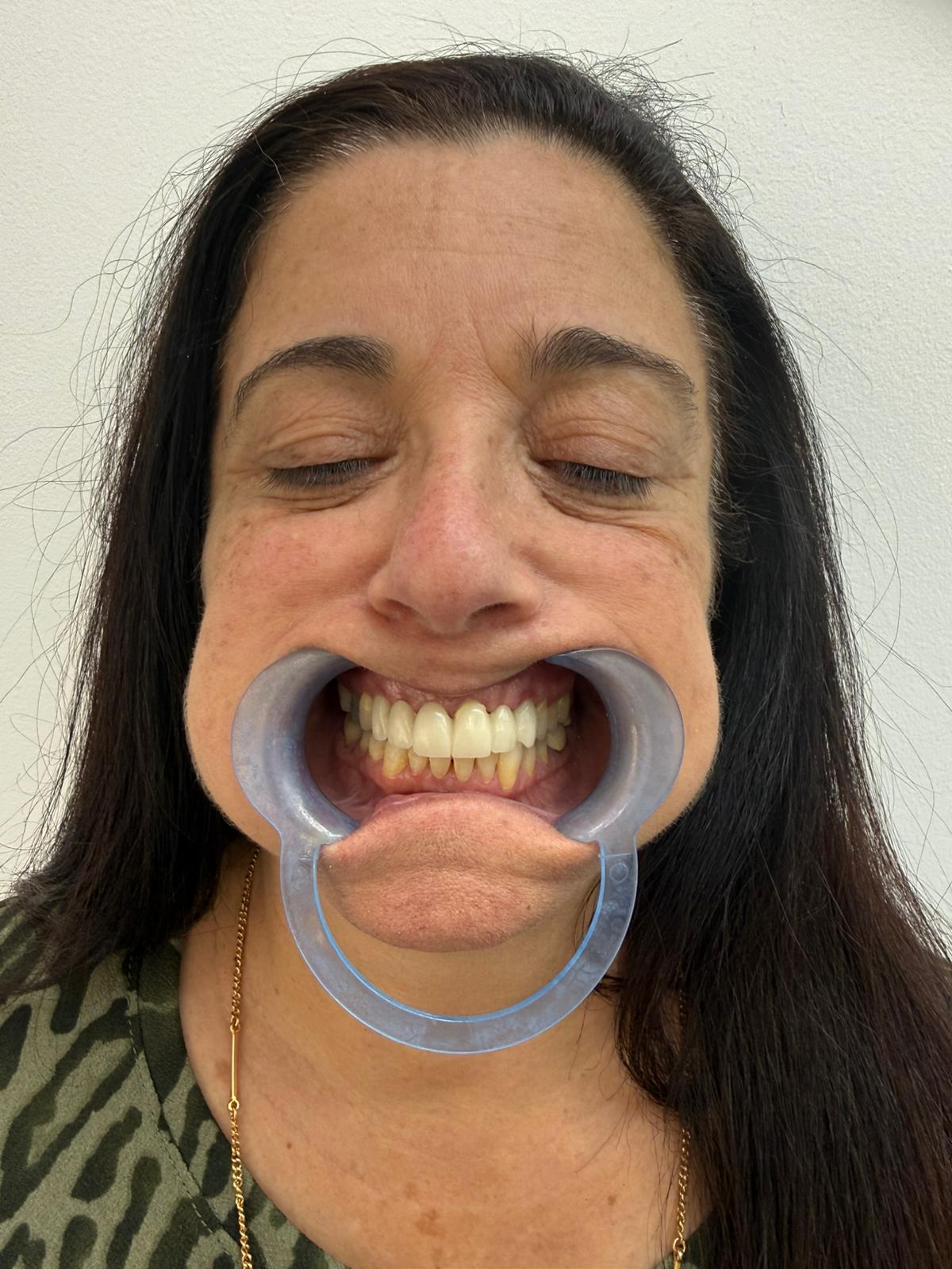 After image alt